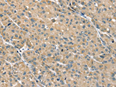 PHLPP1 Antibody