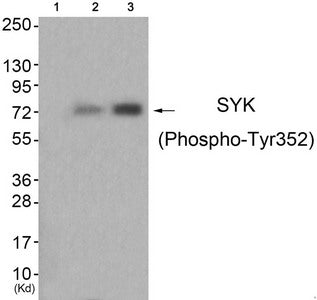 Phospho-SYK (Tyr352) Antibody