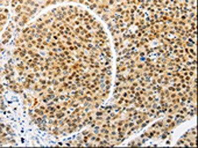 RAN Antibody