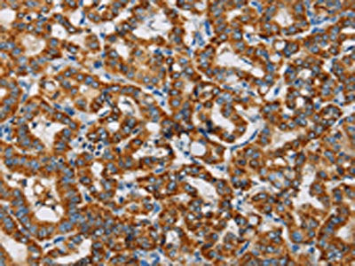 MRPL28 Antibody