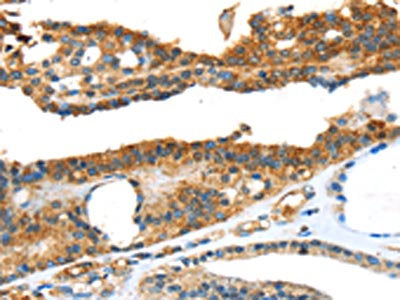 SNAI3 Antibody