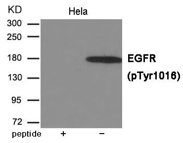 Phospho-EGFR (Tyr1016) Antibody