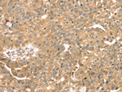 SAMD3 Antibody