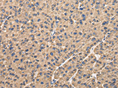 UQCRC1 Antibody