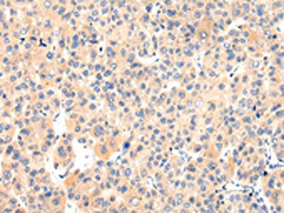 VASH1 Antibody