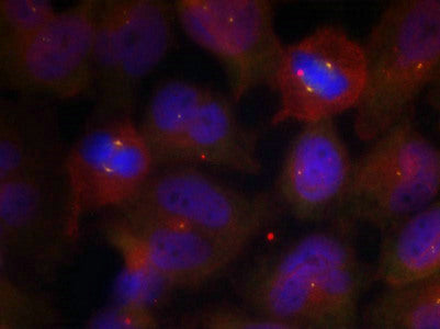 Phospho-SYT1/SYT2 (Thr202/199) Antibody
