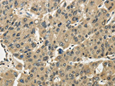 TSSC1 Antibody