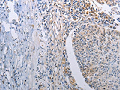 STAT1 Antibody