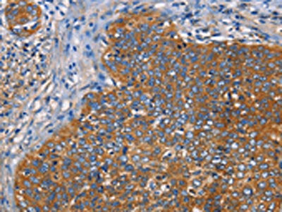 NT5E Antibody