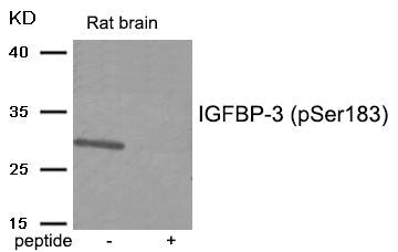 Phospho-IGFBP3 (Ser183) Antibody