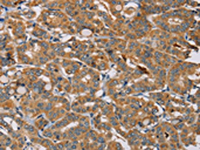 MBNL3 Antibody