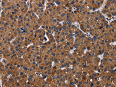 LZTFL1 Antibody