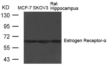 ESR1 (Ab-104) Antibody