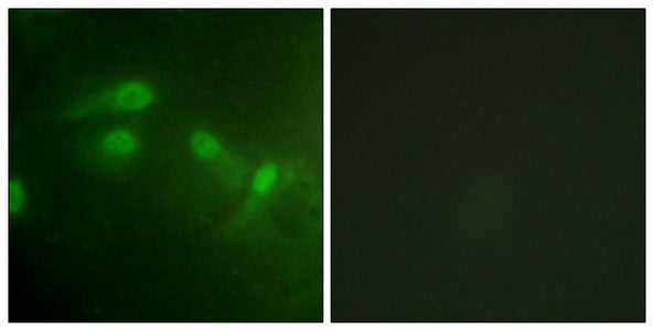 Phospho-MDM2 (Ser186/Ser188) Antibody