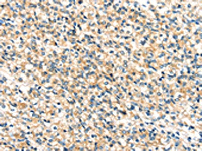 TTI1 Antibody