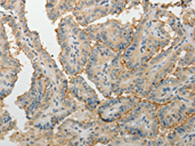 MPZ Antibody