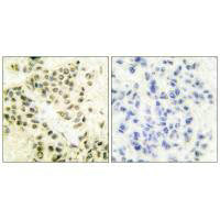PRKDC Antibody