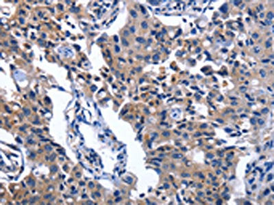 NAT8 Antibody