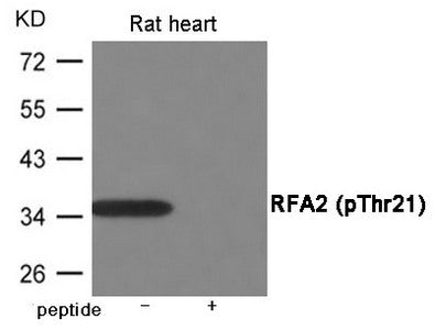 Phospho-RPA2 (Thr21) Antibody