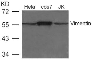 VIM Antibody
