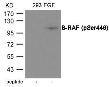 Phospho-BRAF (Ser446) Antibody