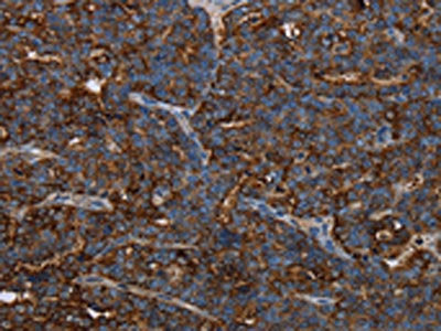 HMGCL Antibody