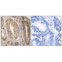 PTK2 (Ab-843) Antibody