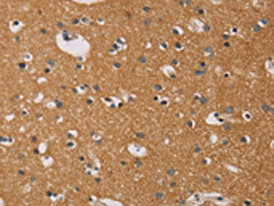 CD22 Antibody