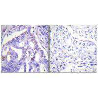 PIAS4 Antibody