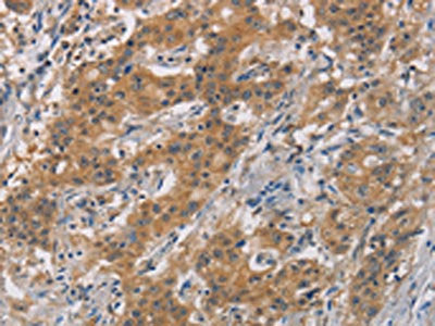 AXIN2 Antibody
