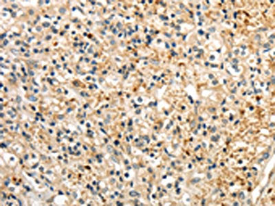 RAB17 Antibody