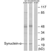 SNCA (Ab-125) Antibody