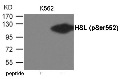 Phospho-LIPE (Ser552) Antibody