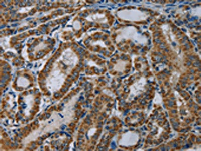 NDUFA5 Antibody