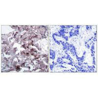 EGFR (Ab-1172) Antibody