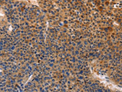 MUSK Antibody
