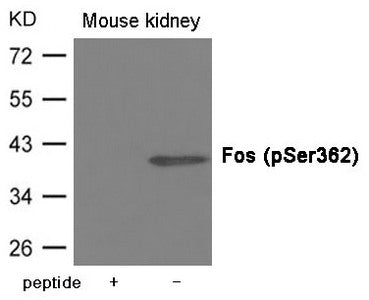 Phospho-FOS (Ser362) Antibody