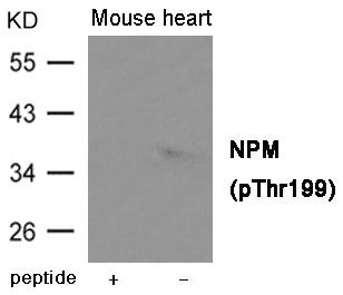 Phospho-NPM1 (Thr199) Antibody
