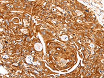 SFTPA1 Antibody