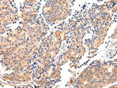 MAP2 Antibody