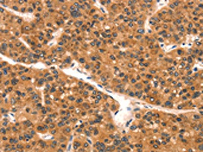 EPPIN Antibody