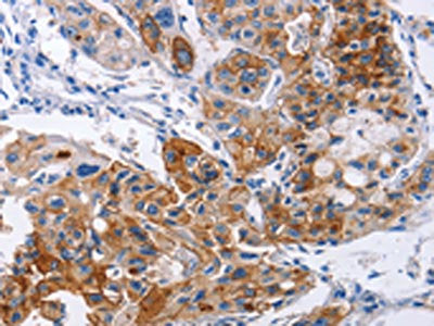 ICAM1 Antibody