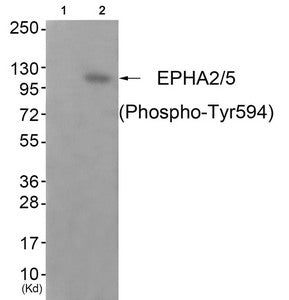 Phospho-EPHA2/EPHA5 (Tyr594) Antibody