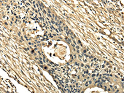 TSSC1 Antibody