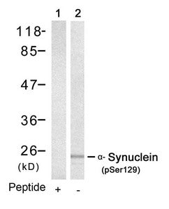 Phospho-SNCA (Ser129) Antibody