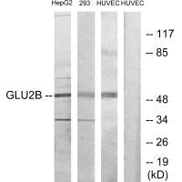 PRKCSH Antibody