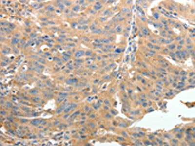TERT Antibody