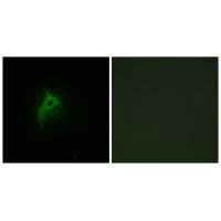 ADRA2B Antibody