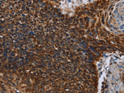 IDH2 Antibody