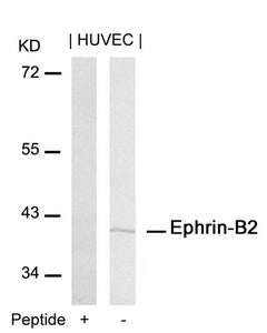 EFNB2 (Ab-316) Antibody